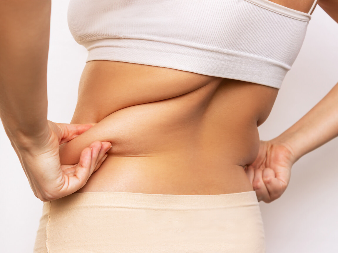 жіночі - жирові складки, схуднення 