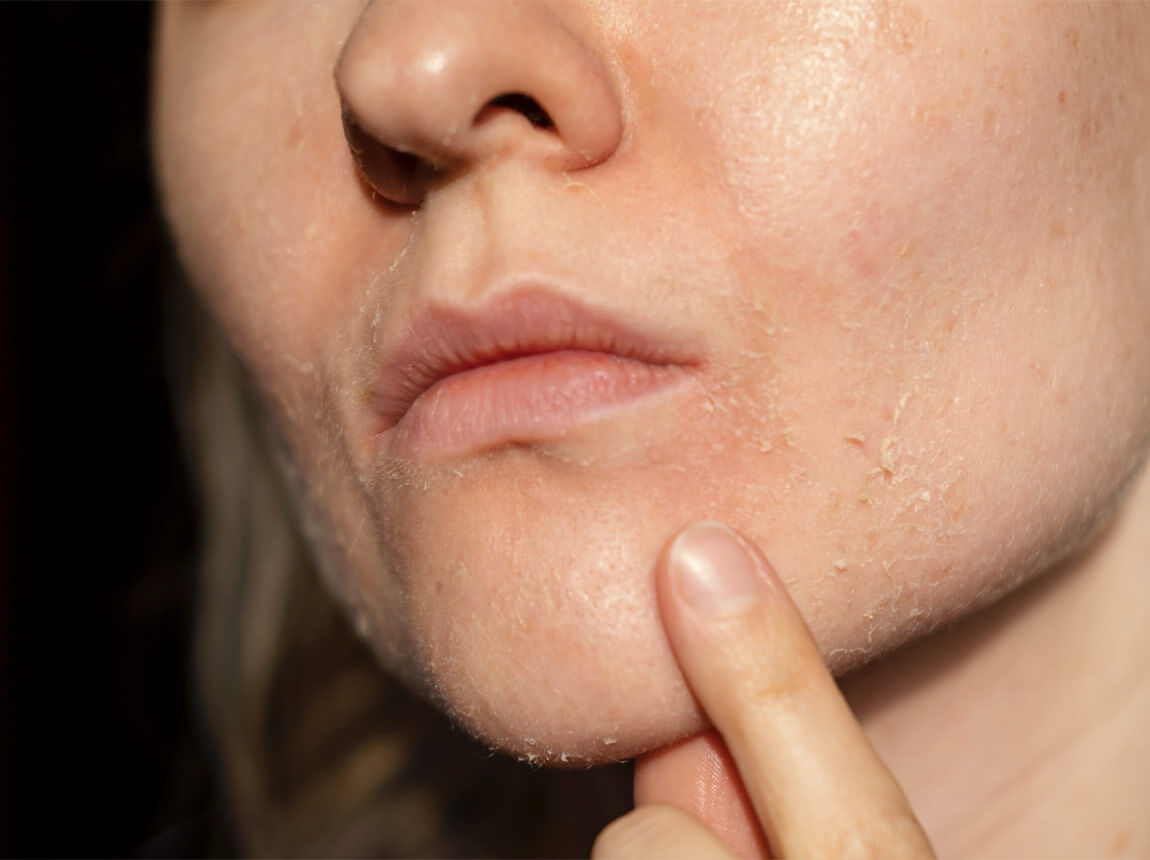 жінка - суха шкіра 