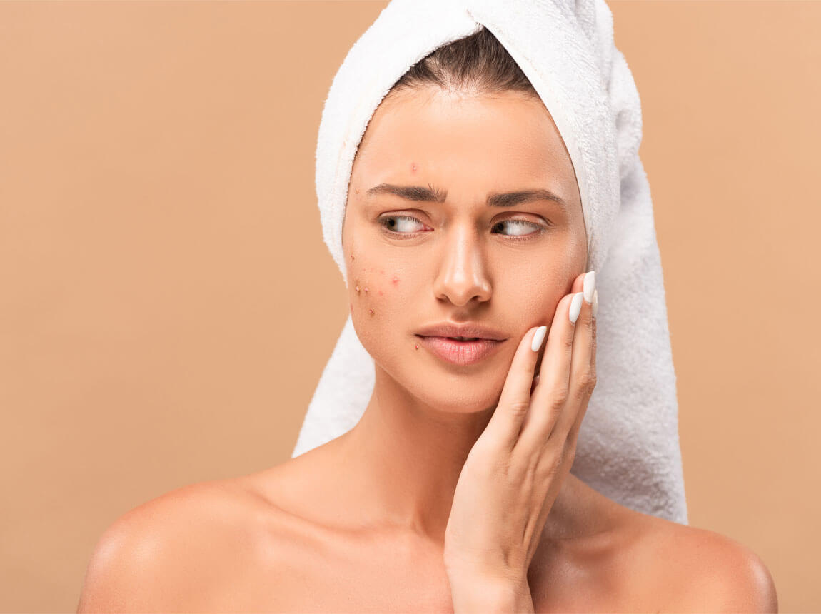 жінки - акне, дефіцит цинку 