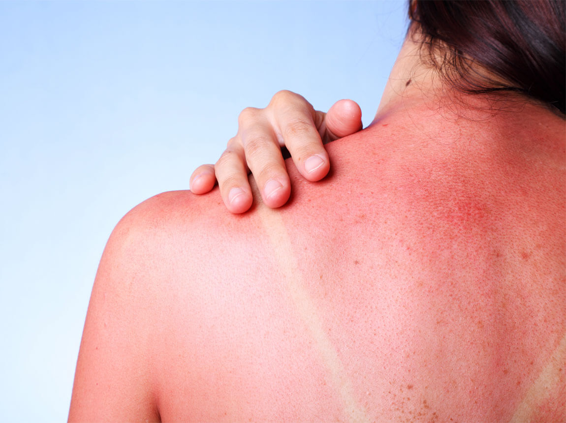 сонячні промені