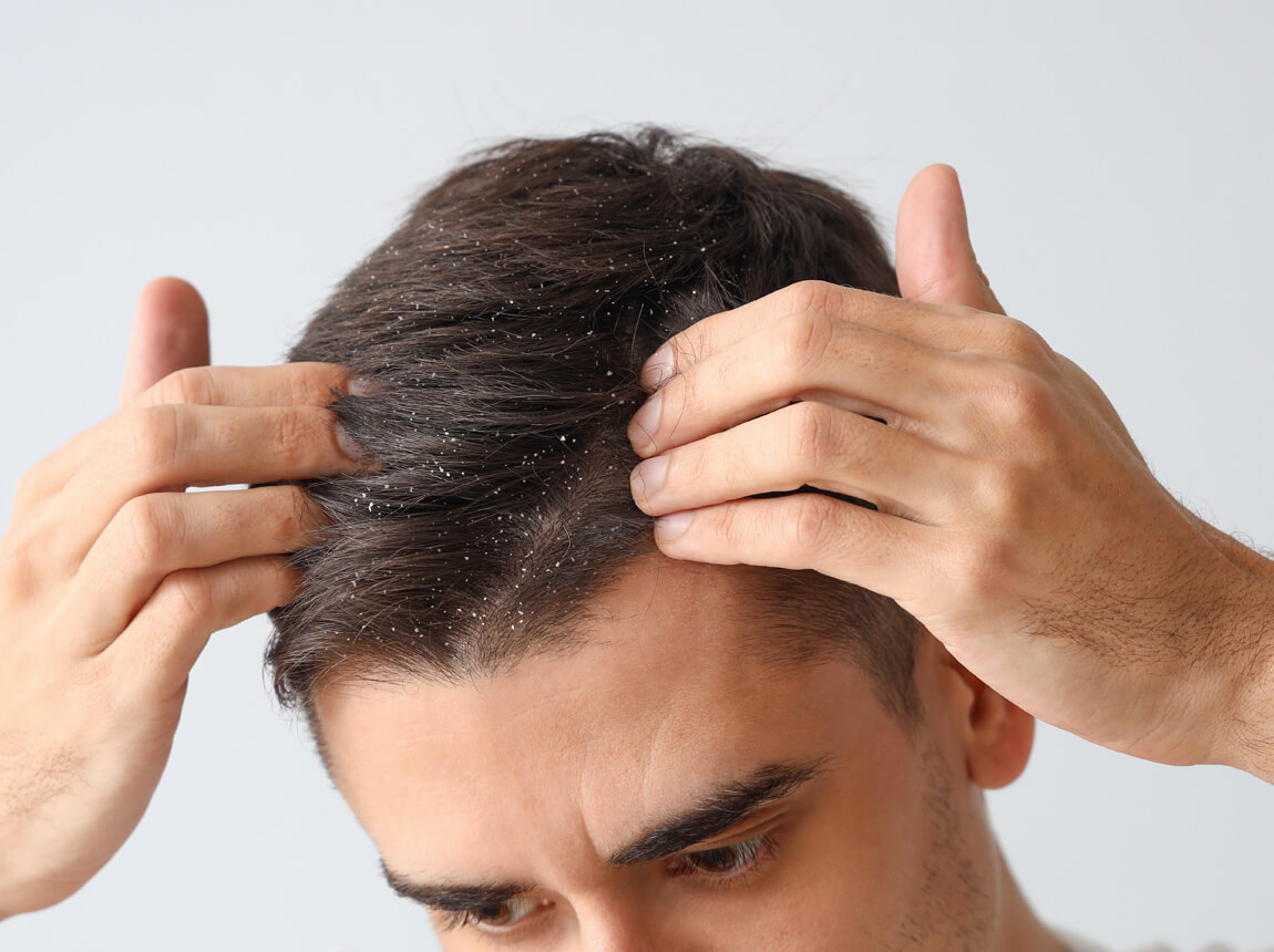 чоловік - лупа на голові 