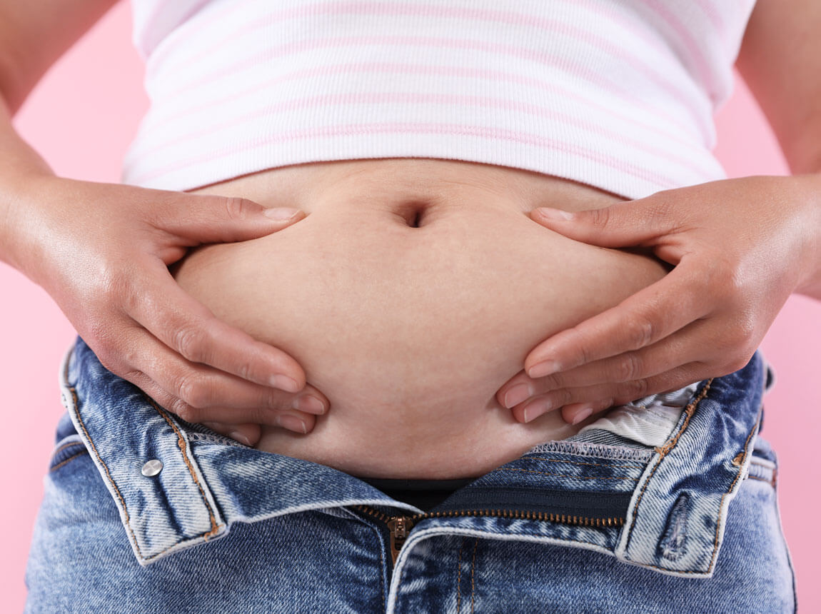 живіт - надмірна вага