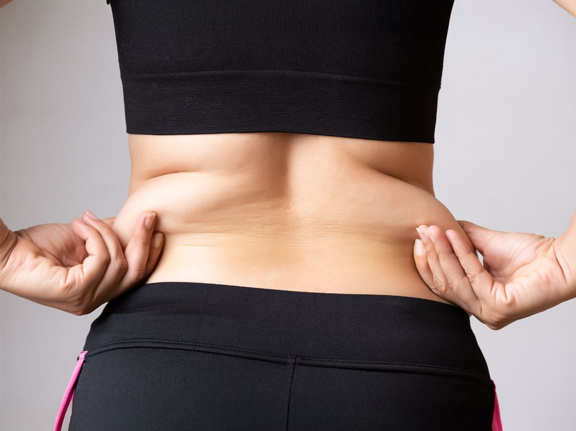 жінка, схуднення, боки