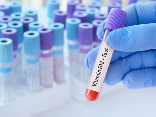 Дефіцит вітаміну В12 - причини, симптоми